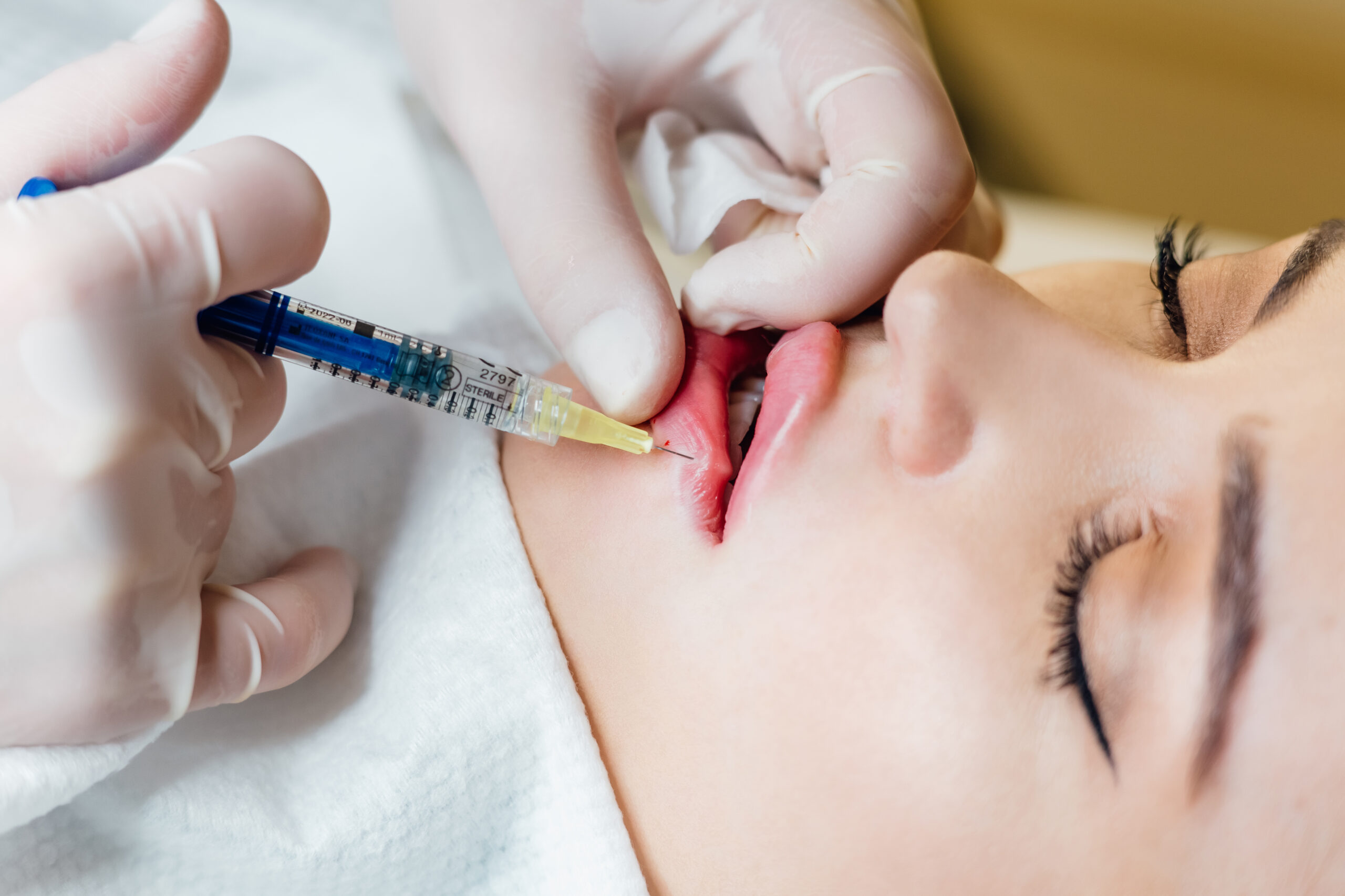 Chirurgie estetică DCH Aesthetic